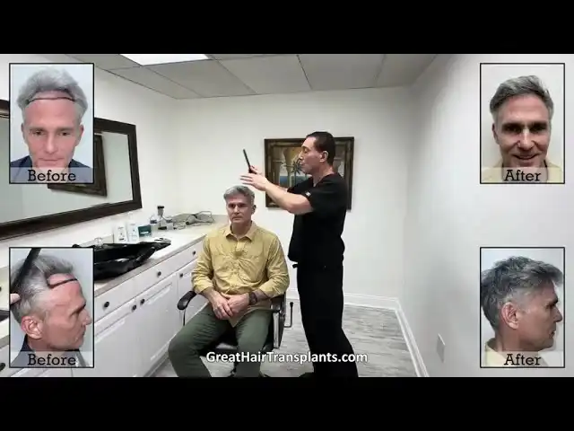 Dr. Brett Bolton MaxHarvest Procedure patient James